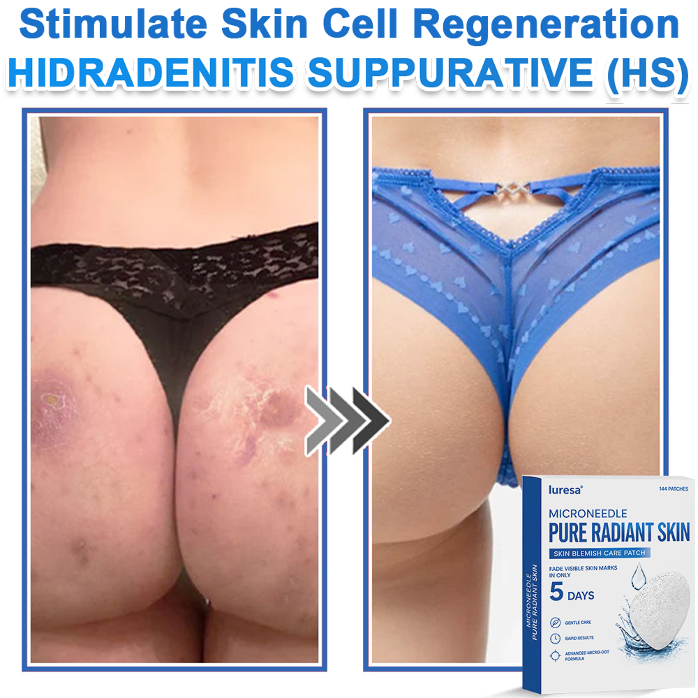 🍁luresa® 2-in-1 Microneedle & Hydrocolloid Patch | Raised Moles,Acne,  Flat Warts & Skin Tags Remover | Improves Wrinkles, Scars & Blemishes | Invisible Pimple Patches for Face & Body