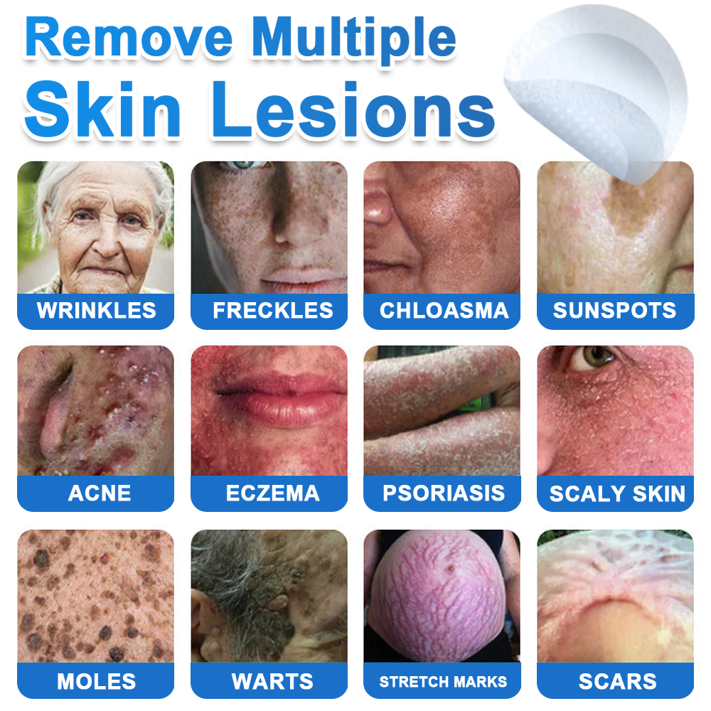 🍁luresa® 2-in-1 Microneedle & Hydrocolloid Patch | Raised Moles,Acne,  Flat Warts & Skin Tags Remover | Improves Wrinkles, Scars & Blemishes | Invisible Pimple Patches for Face & Body