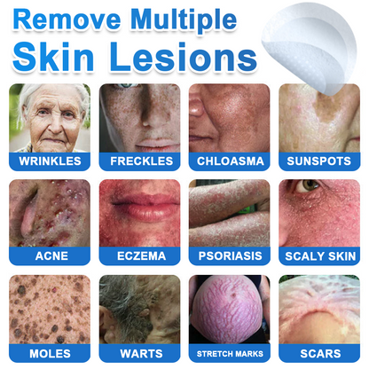 🍁luresa® 2-in-1 Microneedle & Hydrocolloid Patch | Raised Moles,Acne,  Flat Warts & Skin Tags Remover | Improves Wrinkles, Scars & Blemishes | Invisible Pimple Patches for Face & Body