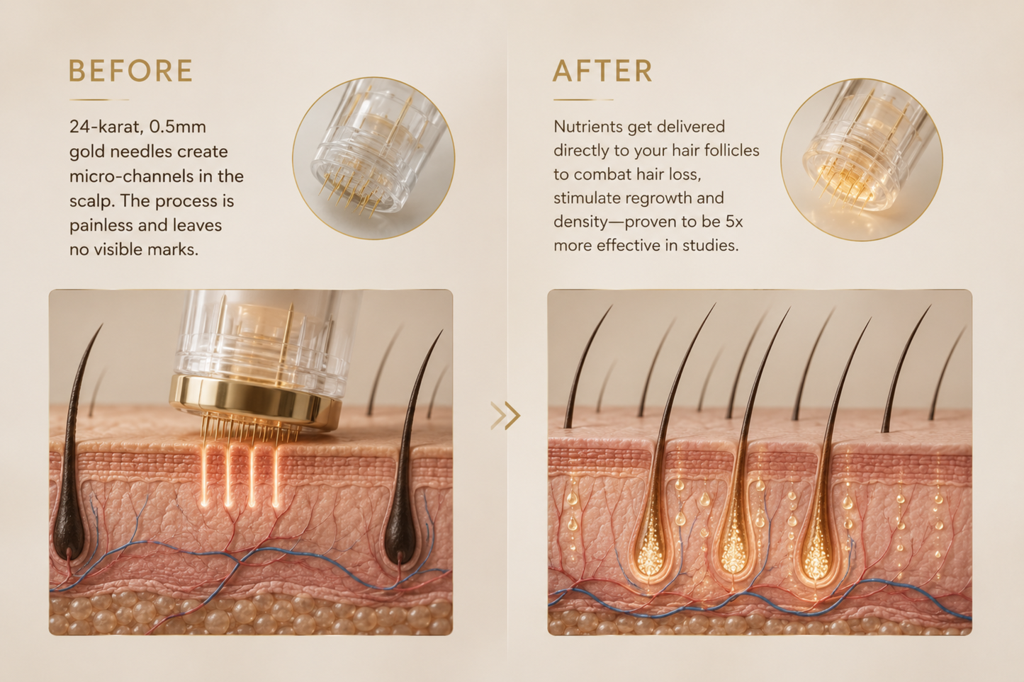 PETLUXECOS™ Hair Regrowth System