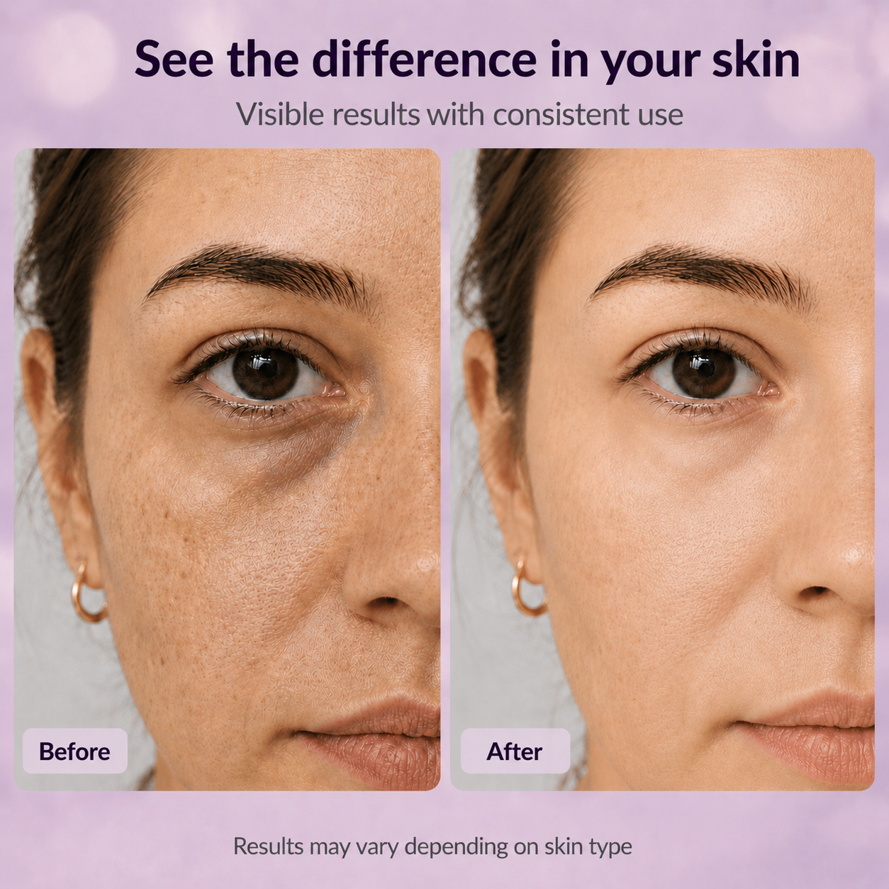 Cemenrete Calcium Dark Spot Eye Cream | Dark Circle, Anti-aging, Sagging, Elasticity