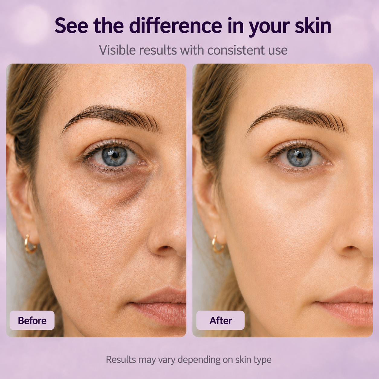 Cemenrete Calcium Dark Spot Eye Cream | Dark Circle, Anti-aging, Sagging, Elasticity