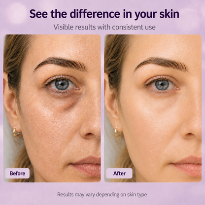 Cemenrete Calcium Dark Spot Eye Cream | Dark Circle, Anti-aging, Sagging, Elasticity